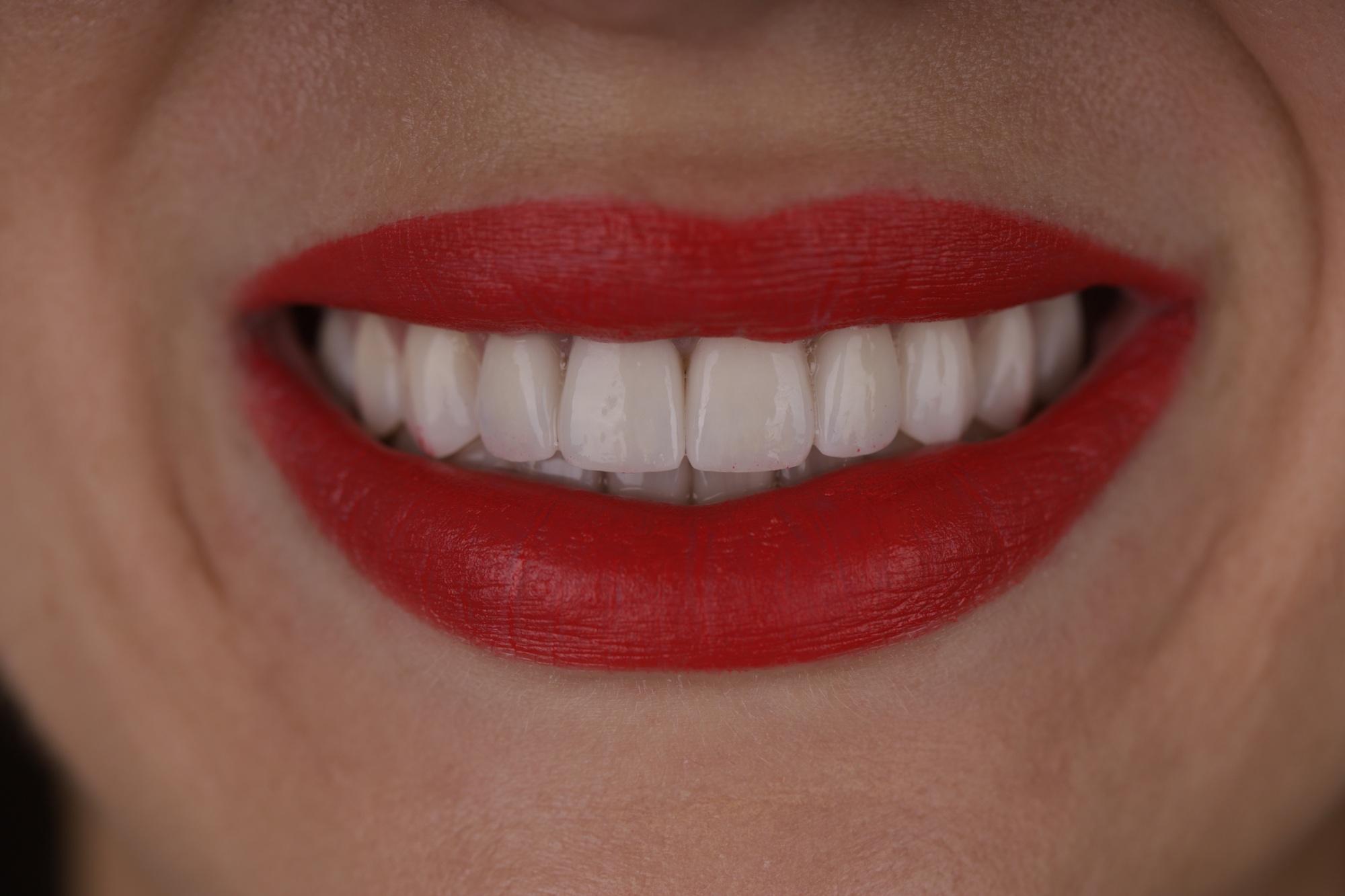 Эстетическая стоматология